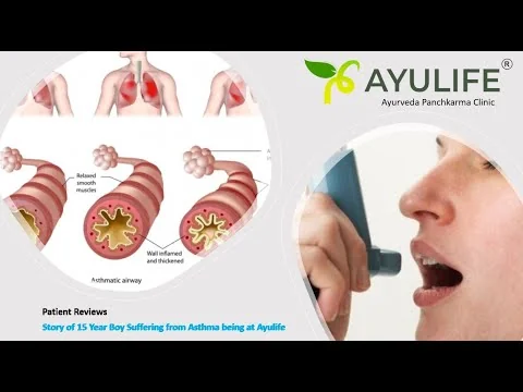 Asthma care testimonial from Ayulife Hospital