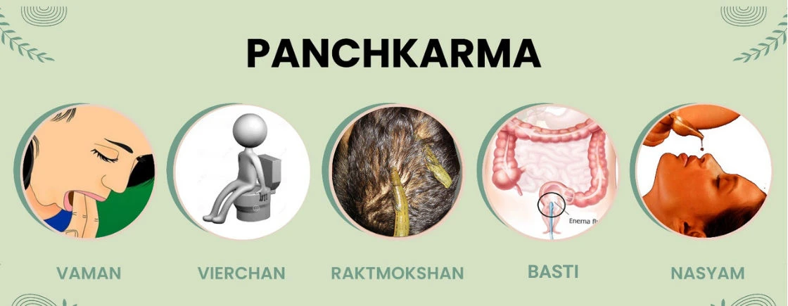 Ayulife Panchakarma Treatment