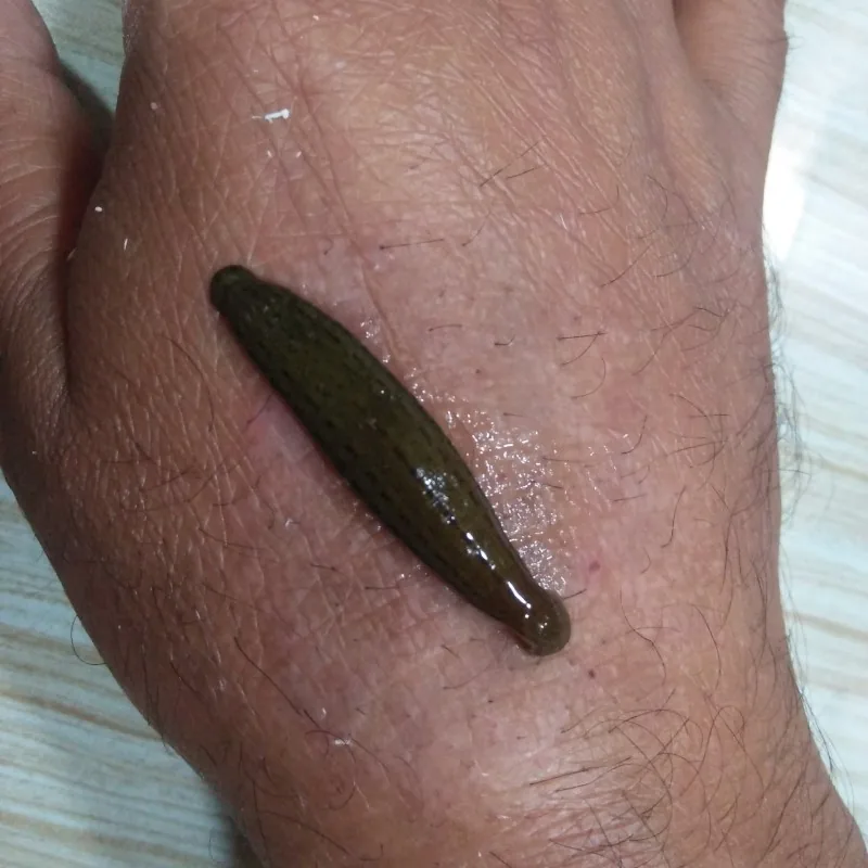 Panchakarma support for psoriasis