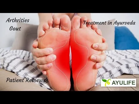 Patient testimonial on Panchakarma knee care at Ayulife.