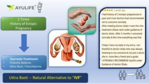 History-of-Ectopic-Pregnancy-in-Ayulife
